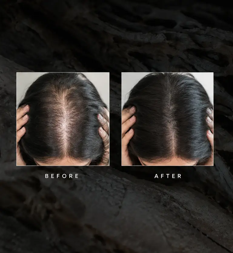 Before-and-after image used for Anti-Hairloss Treatment in the Dr.Scalp service menu