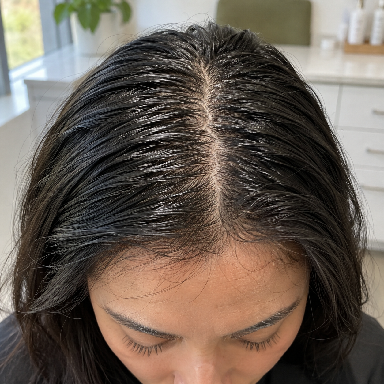 Oily hair roots lying together beside a scalp part